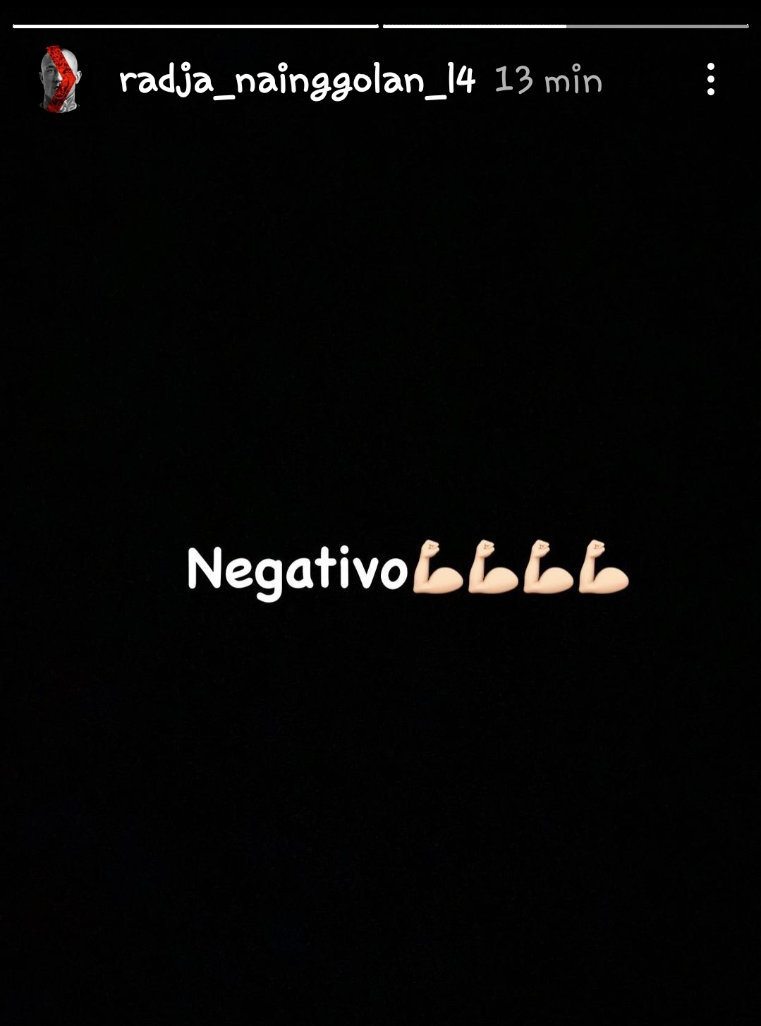 Inter, Nainggolan guarito dal Coronavirus - FOTO 34 EkizTm WMAEUXda