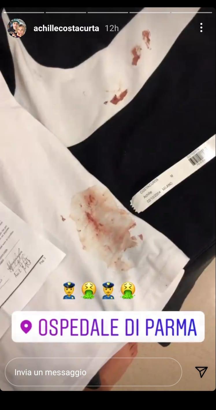 Costacurta Jr denuncia: «Picchiato dalla Polizia, timpano perforato» - FOTO 40 WhatsApp Image 2021 05 12 at 15.02.11