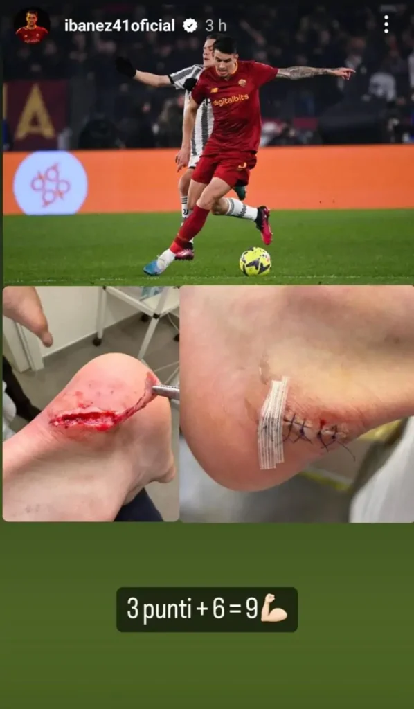Roma, Ibanez punge sui social dopo la vittoria sulla Juve 30 Ibanez