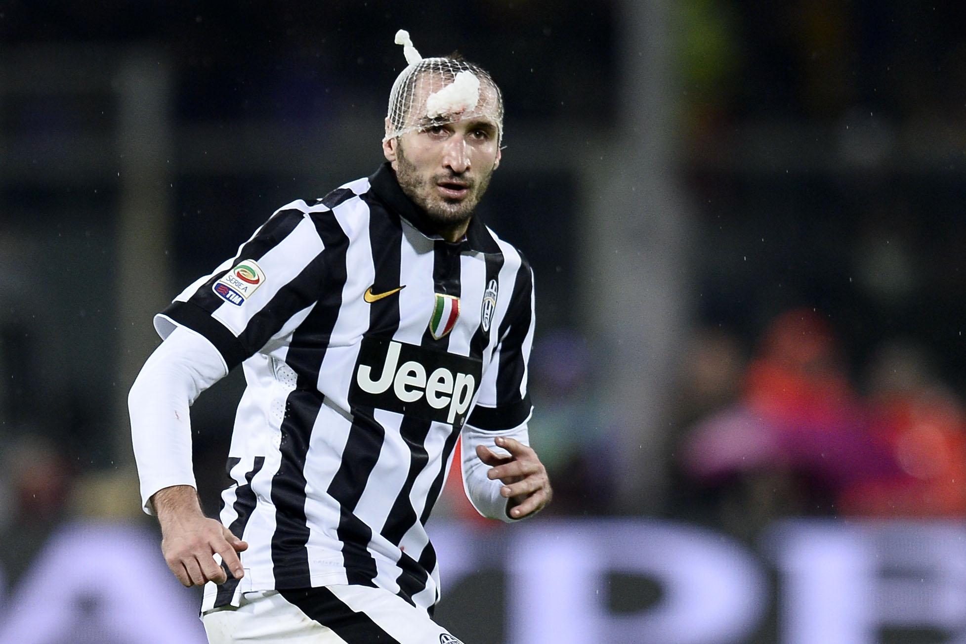 chiellini fasciato juventus dicembre 2014 ifa